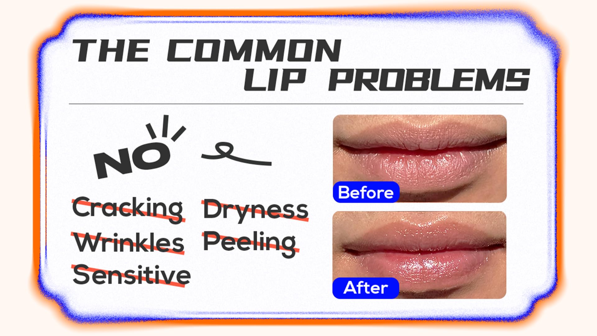 EqualRXN Goji Ectoin Recovery Lip Balm | Nourishing & Non Greasy Lip Treatment | Papaya Enzyme, Goji, Ectoin, Vitamin C to Support Lip Barrier & Wrinkles | For Dryness Cracked Lip Day & Night Use